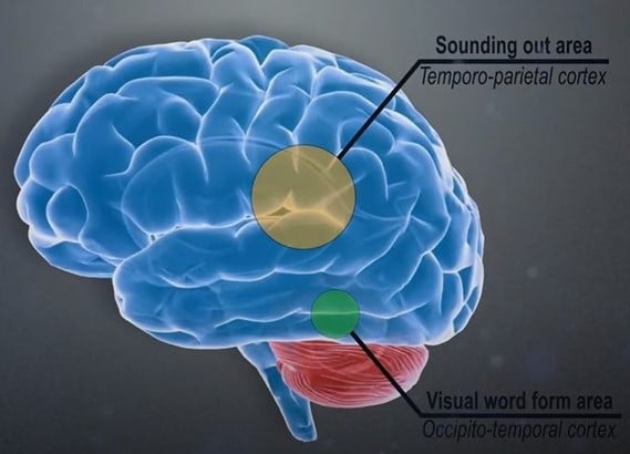 Orthographic dyslexia and the brain.