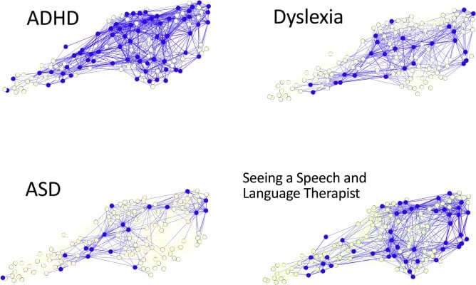 Dyslexia brain connectivity scans
