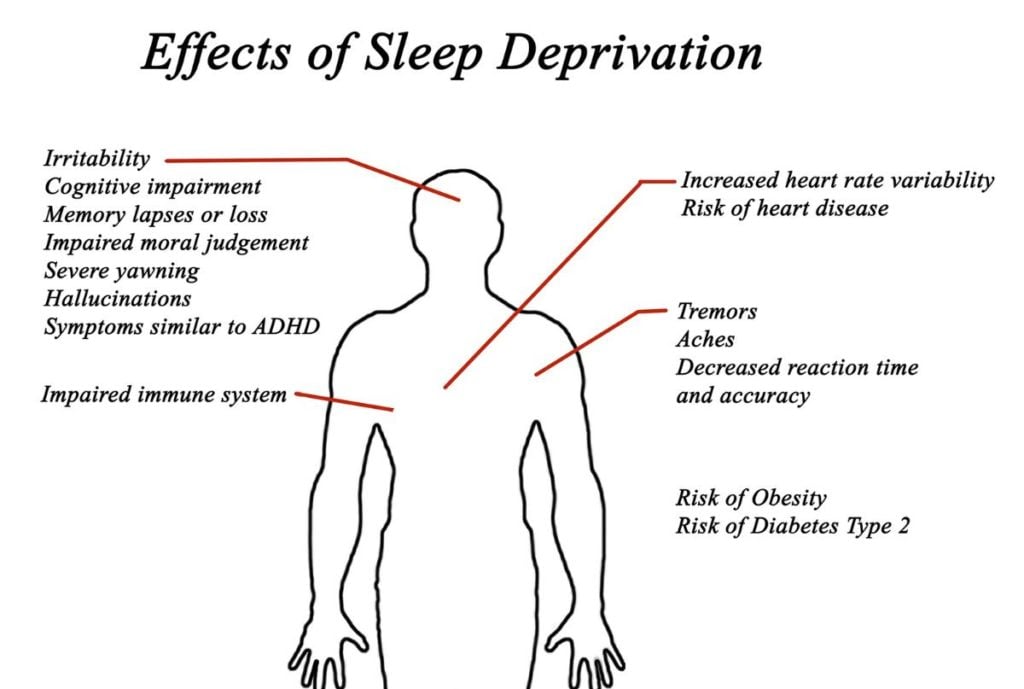 Effects of Sleep Deprivation 